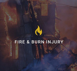 fire and burn injury