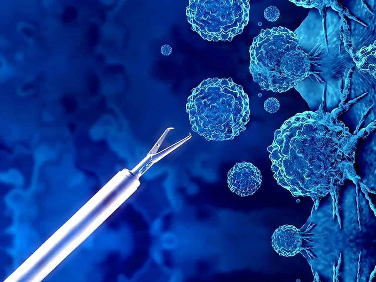Power morcellator surgery