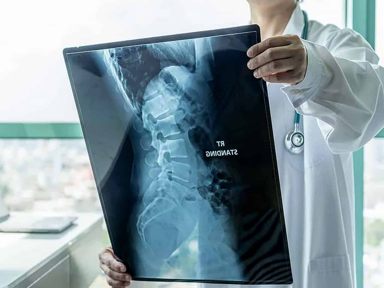 Doctor reviewing spine xray